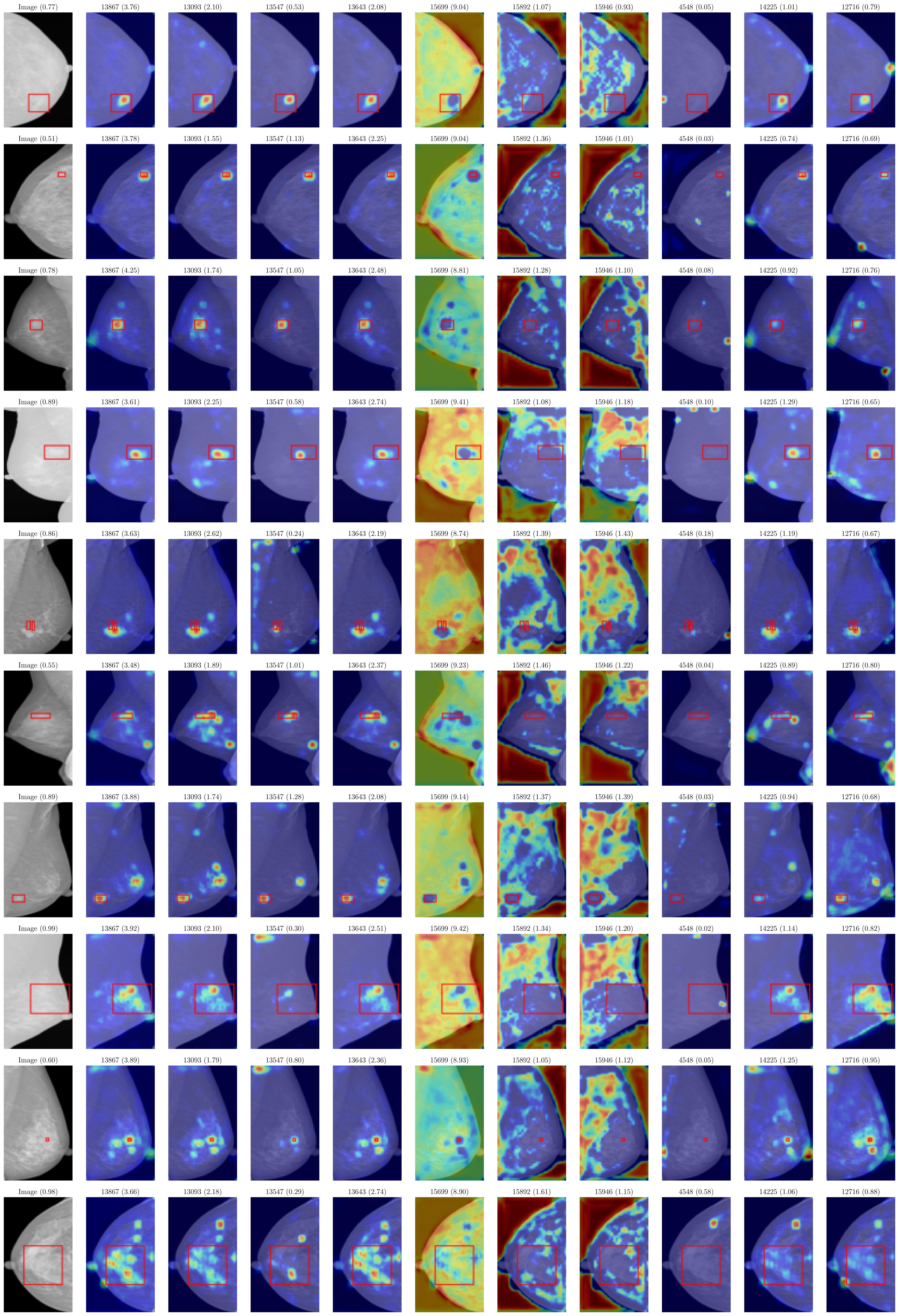 Latent visualization of Suspicious Calcification
