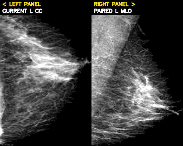 Paired view example
